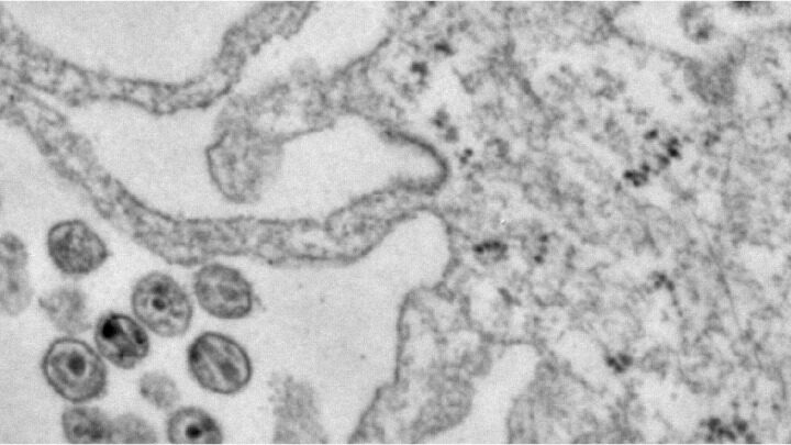 Electron microscope image of viral particles produced in HIV-infected human immune cells (macrophages).